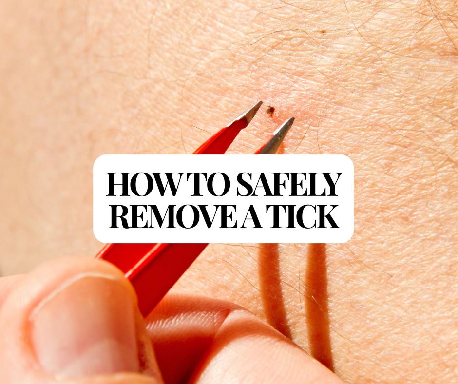 How to safely remove ticks